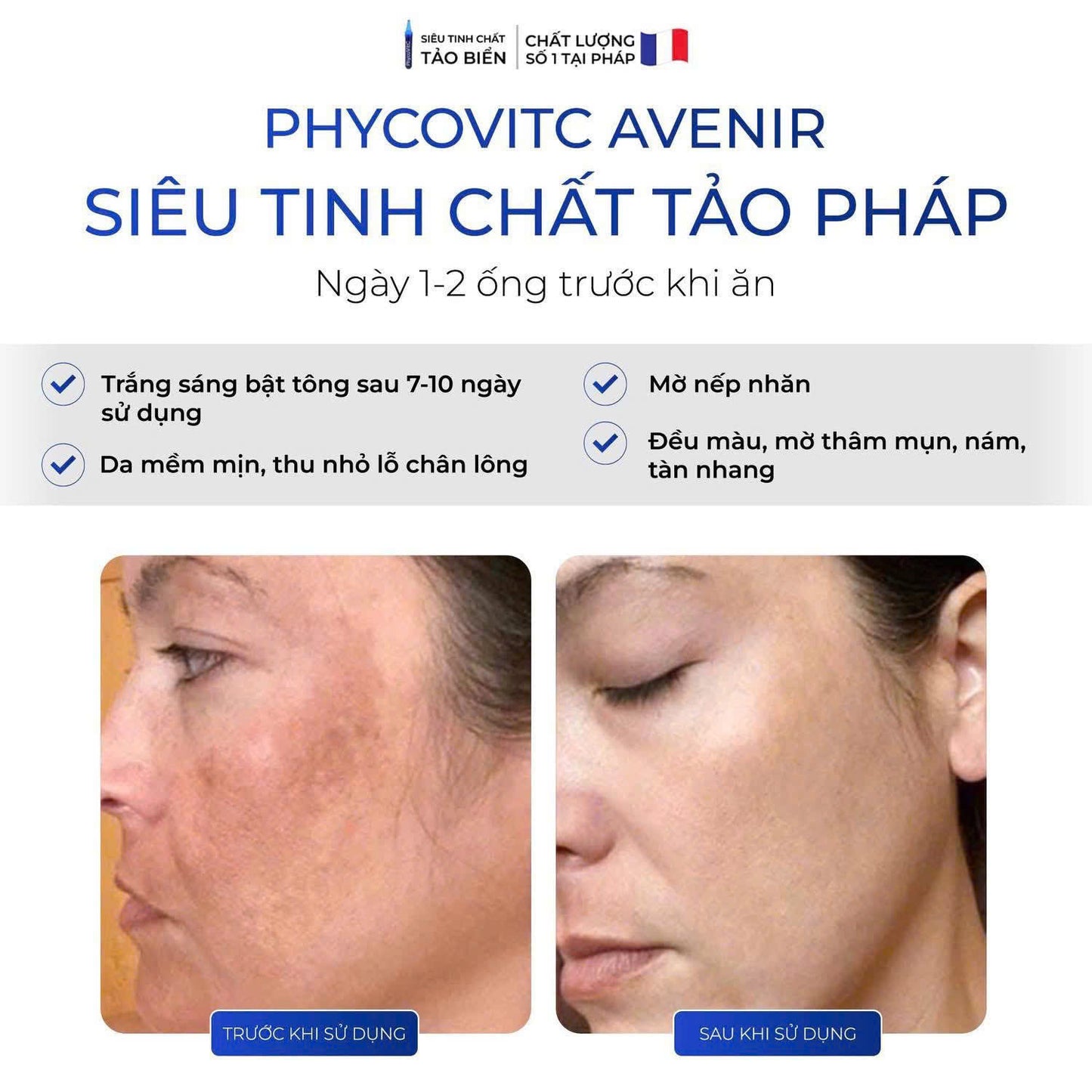 SIÊU TINH CHẤT TẢO PHÁP PHYCOVITC AVENIR